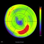 CT Herz Function