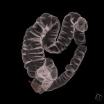 CT-Colonographie